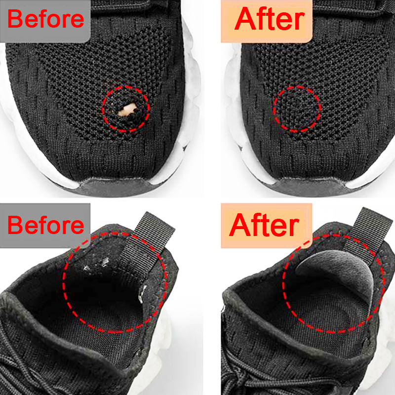 Sports Shoes Patches Vamp Repa - Sneaker Shoe Care Kit ulasan dan harga